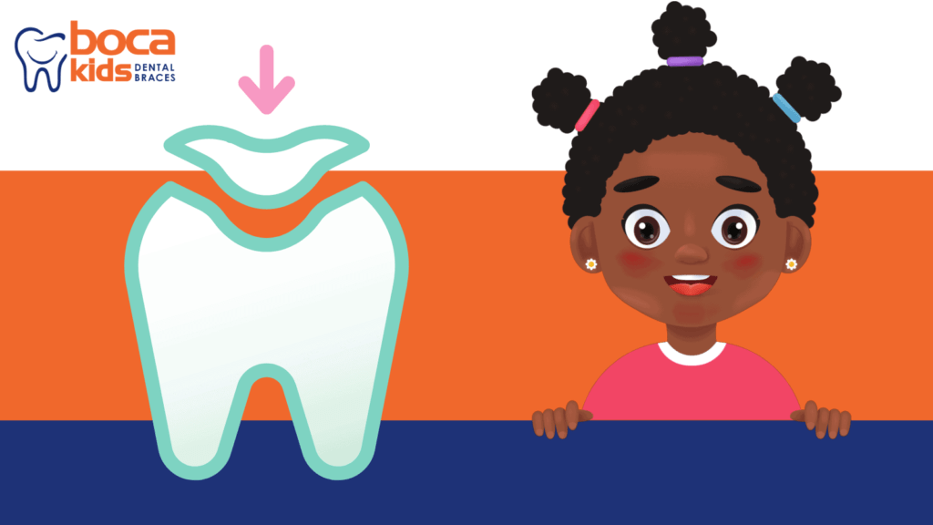Tooth-colored fillings kids