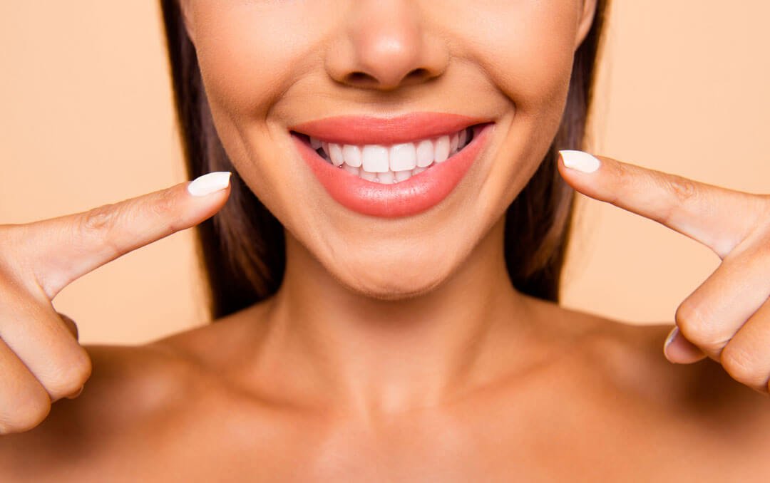 veneer services las vegas