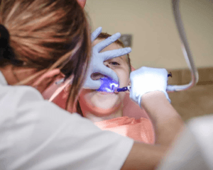 Tooth-Colored Fillings