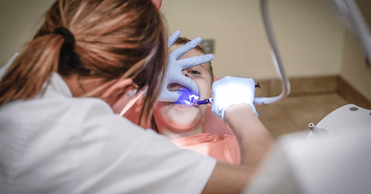 Tooth-Colored Fillings