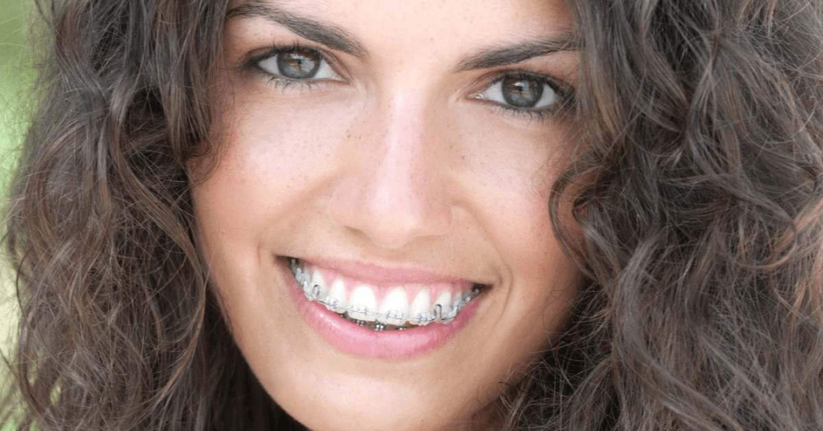 braces near me