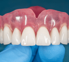 denture repair services