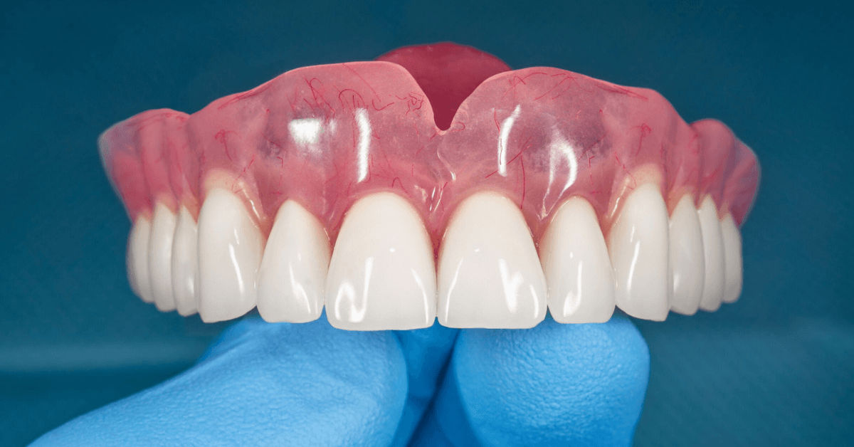 denture repair services