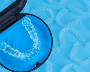 Invisalign aligners