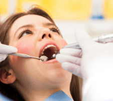 deep dental cleanings