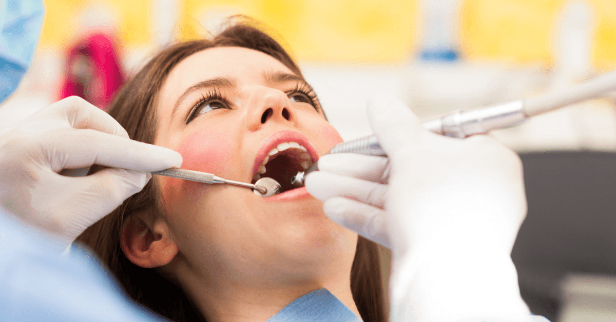 deep dental cleanings