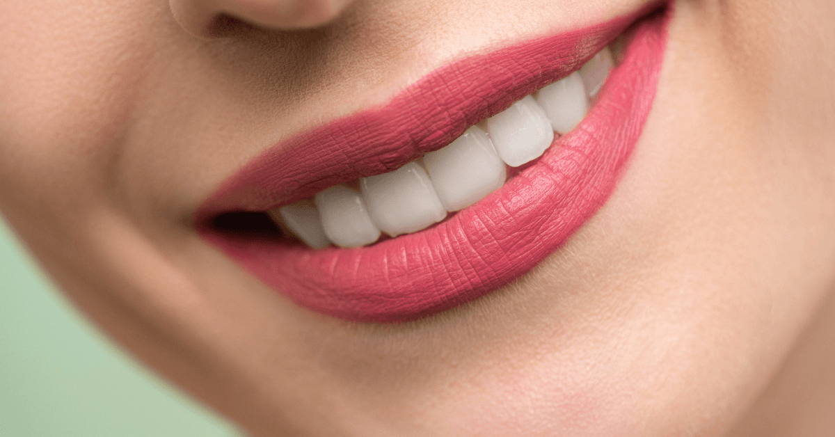 teeth whitening treatments