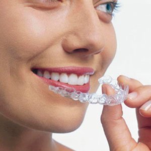 Best Invisalign in Las Vegas